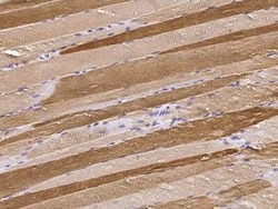 PKLR Antibody, Novus Biologicals:Antibodies:Primary Antibodies