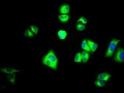 PKM2 Antibody (7B2), Novus Biologicals 100 &mu;g | Buy Online | Bio-Techne | Fisher Scientific