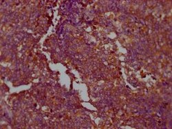 PKM2 Antibody (7B2), Novus Biologicals 100 &mu;g | Buy Online | Bio-Techne | Fisher Scientific