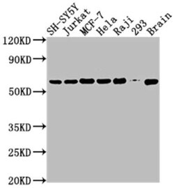 PKM2 Antibody (7B2), Novus Biologicals 100 &mu;g | Buy Online | Bio-Techne | Fisher Scientific