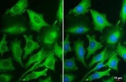 PKM2 Antibody (GT1810), Novus Biologicals 100 &mu;g; Unconjugated:Antibodies,