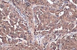 PKM2 Antibody (GT1810), Novus Biologicals 100 &mu;g; Unconjugated:Antibodies,