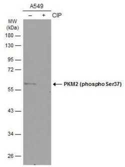 PKM2, p Ser37 Antibody, Novus Biologicals 100 &mu;g; Unconjugated:Antibodies,