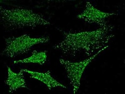 PKN1 Antibody, Novus Biologicals:Antibodies:Primary Antibodies