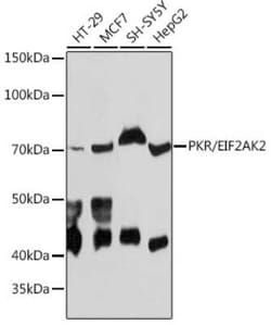PKR Rabbit anti-Human, Rat, Clone: 5B7B6, Novus Biologicals 20 &mu;g | Buy Online | Novus Biologicals | Fisher Scientific