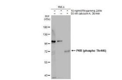 PKR, p Thr446 Antibody, Novus Biologicals 100 &mu;g | Buy Online | Novus Biologicals | Fisher Scientific