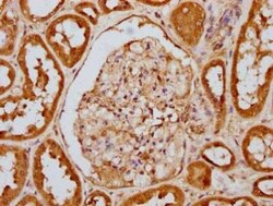 PKR, p Thr449 Antibody (2F8), Novus Biologicals 100 &mu;g | Buy Online | Novus Biologicals | Fisher Scientific