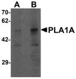 PLA1A Antibody - BSA Free, Novus Biologicals 0.1 mg; Unconjugated:Antibodies,