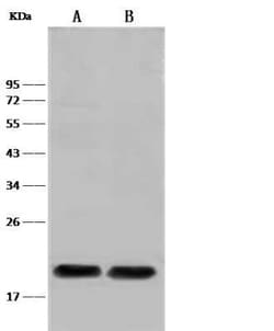 PLA2G12B Antibody, Novus Biologicals 100 &mu;g; Unconjugated:Antibodies,