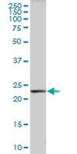 PLA2G16/HRASLS3 Antibody, Novus Biologicals 0.05 mg | Buy Online | Novus Biologicals | Fisher Scientific