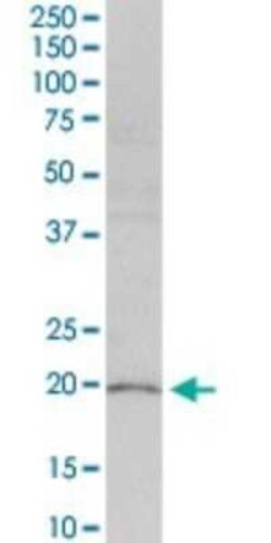 PLA2G16/HRASLS3 Antibody, Novus Biologicals 0.1 mg | Buy Online | Novus Biologicals | Fisher Scientific
