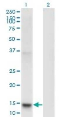 PLA2G1B Antibody (2B7), Novus Biologicals 0.1 mg | Buy Online | Novus Biologicals | Fisher Scientific