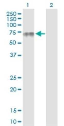 PLA2G3 Antibody, Novus Biologicals 0.1 mg | Buy Online | Novus Biologicals | Fisher Scientific