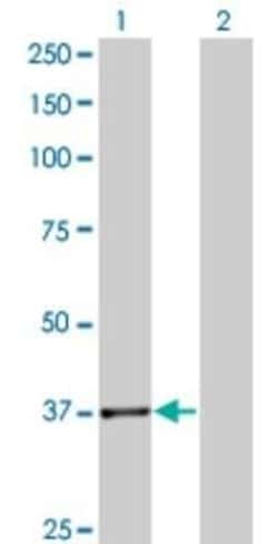 PLA2G4B Antibody (1G5), Novus Biologicals 0.1 mg, Unconjugated:Antikörper