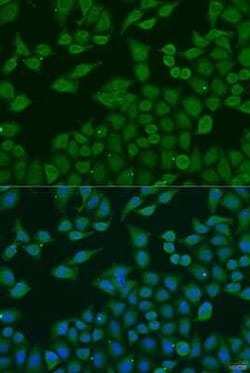 PLA2G4C Antibody - BSA Free, Novus Biologicals:Antibodies:Primary Antibodies