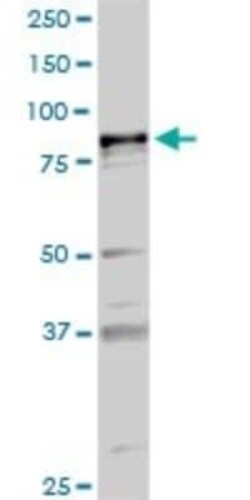 PLA2G6 Antibody, Novus Biologicals 0.1 mg | Buy Online | Novus Biologicals | Fisher Scientific