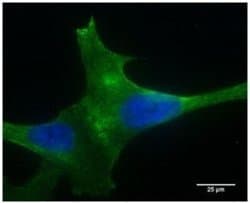 PLA2R1 Antibody (12-6-5) - Azide and BSA Free, Novus Biologicals 0.1 mL;
