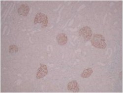 PLA2R1 Antibody (12-6-5) - Azide and BSA Free, Novus Biologicals 0.1 mL;