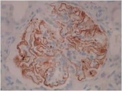 PLA2R1 Antibody (12-6-5) - Azide and BSA Free, Novus Biologicals 0.1 mL;