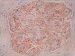 PLA2R1 Antibody (12-6-5) - Azide and BSA Free, Novus Biologicals 0.1 mL;