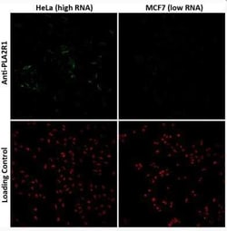 PLA2R1 Antibody (CL0474), Novus Biologicals 25 &mu;L, Unconjugated:Antibodies,