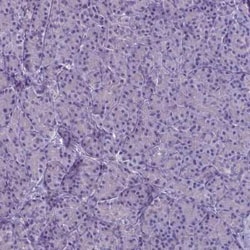 PLA2R1 Antibody (CL0474), Novus Biologicals 25 &mu;L, Unconjugated:Antibodies,