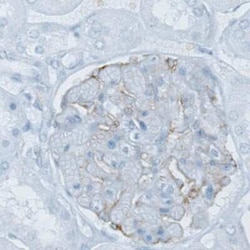 PLA2R1 Antibody (CL0474), Novus Biologicals 25 &mu;L, Unconjugated:Antibodies,
