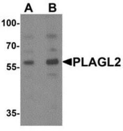 PLAGL2 Antibody - BSA Free, Novus Biologicals 0.1 mg; Unconjugated:Antibodies,