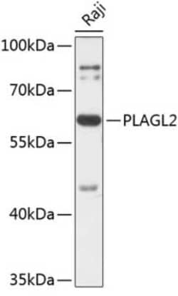 PLAGL2 Antibody - Azide and BSA Free, Novus Biologicals:Antibodies:Primary