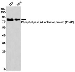 PLAP Rabbit anti-Human, Clone: S06-1D7, Novus Biologicals 25 &mu;g; Unconjugated:Antibodies,
