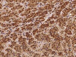 PLBD2 Antibody, Novus Biologicals 100 &mu;g; Unconjugated:Antibodies, Polyclonal