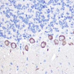PLC-beta 3 Antibody - Azide and BSA Free, Novus Biologicals:Antibodies:Primary