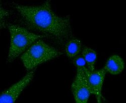 PLC-gamma1 Rabbit anti-Human, Clone: SN06-10, Novus Biologicals 100&mu;L:Antibodies,