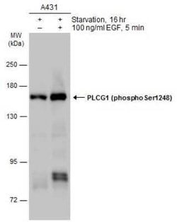 PLC-gamma 1, p Ser1248 Antibody, Novus Biologicals 100 &mu;g; Unconjugated:Antibodies,