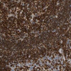 PLC-gamma 2 Antibody, Novus Biologicals:Antibodies:Primary Antibodies