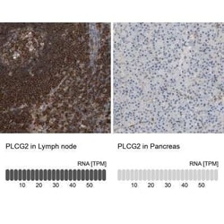 PLC-gamma 2 Antibody, Novus Biologicals:Antibodies:Primary Antibodies