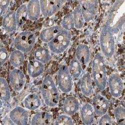 PLC-gamma 2 Antibody, Novus Biologicals:Antibodies:Primary Antibodies
