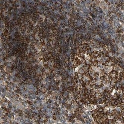 PLC-gamma 2 Antibody, Novus Biologicals 0.1 mL; Unconjugated:Antibodies,