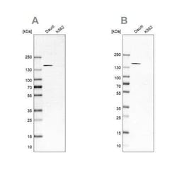 PLC-gamma 2 Antibody, Novus Biologicals 0.1 mL; Unconjugated:Antibodies,