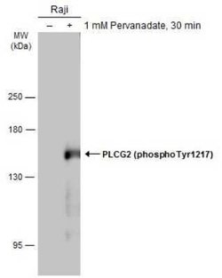 PLC-gamma 2, p Tyr1217 Antibody, Novus Biologicals 100 &mu;g; Unconjugated:Antibodies,