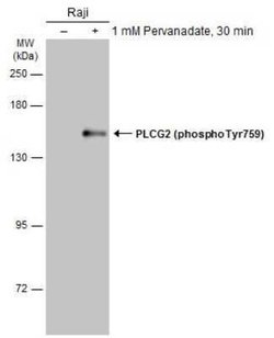 PLC-gamma 2, p Tyr759 Antibody, Novus Biologicals 100 &mu;g | Buy Online | Novus Biologicals | Fisher Scientific