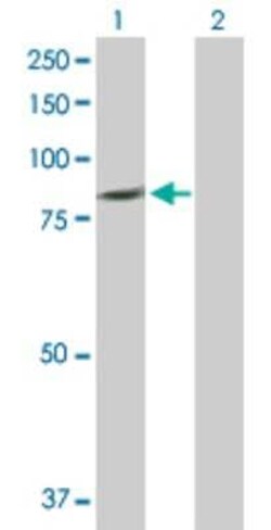 PLCD4 Antibody, Novus Biologicals 0.1 mg | Buy Online | Novus Biologicals | Fisher Scientific