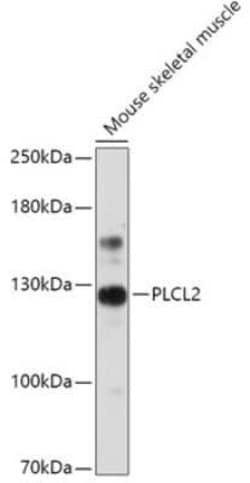 PLCL2 Antibody - Azide and BSA Free, Novus Biologicals 0.1 mL; Unconjugated:Antibodies,
