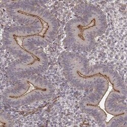PLEKHG3 Antibody, Novus Biologicals 25 &mu;L | Buy Online | Novus Biologicals | Fisher Scientific