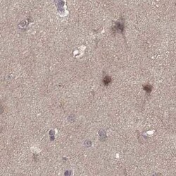 PLEKHG3 Antibody, Novus Biologicals 25ul; Unconjugated:Antibodies, Polyclonal