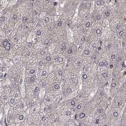 PLEKHG3 Antibody, Novus Biologicals 25ul; Unconjugated:Antibodies, Polyclonal