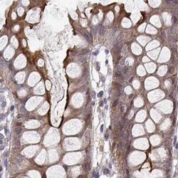 PLEKHG3 Antibody, Novus Biologicals 25 &mu;L | Buy Online | Novus Biologicals | Fisher Scientific