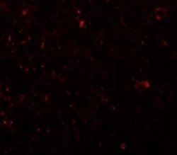 PLEKHM3 Antibody - BSA Free, Novus Biologicals 0.1 mg | Buy Online | Novus Biologicals | Fisher Scientific