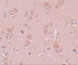 PLEKHM3 Antibody - BSA Free, Novus Biologicals 0.1 mg | Buy Online | Novus Biologicals | Fisher Scientific