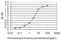 PLEKHO2 Antibody (3D9), Novus Biologicals 0.1 mg | Buy Online | Novus Biologicals | Fisher Scientific
